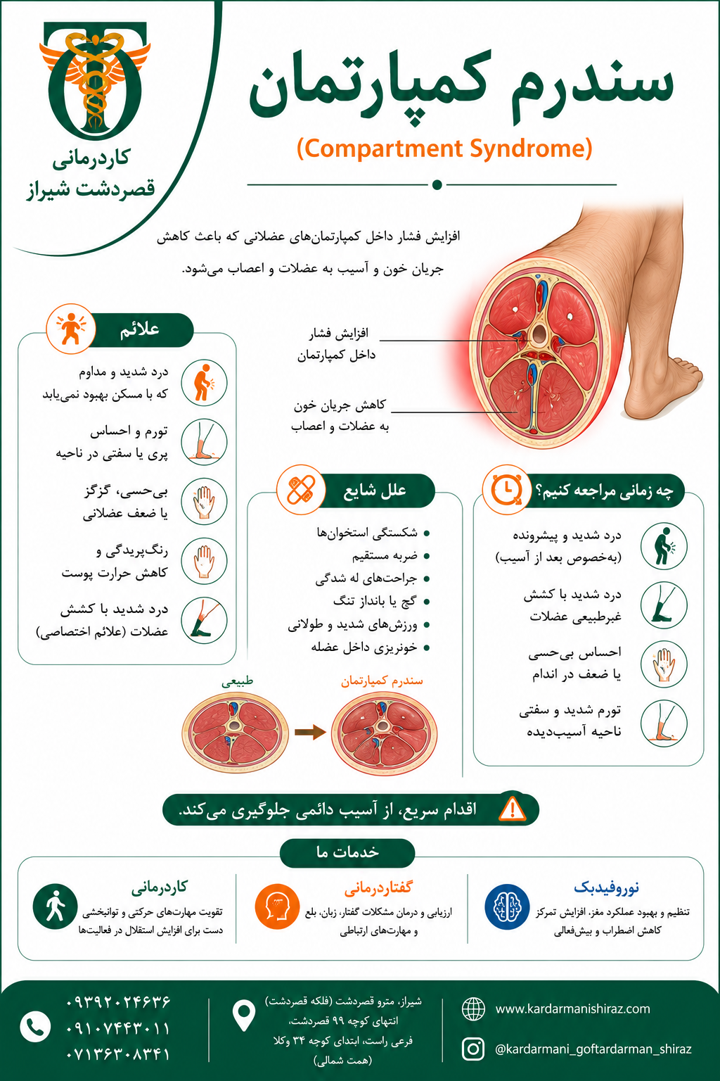 سندرم کمپارتمان (ایسکمی ولکمن)؛ علائم، تشخیص و نقش کاردرمانی شیراز در توانبخشی