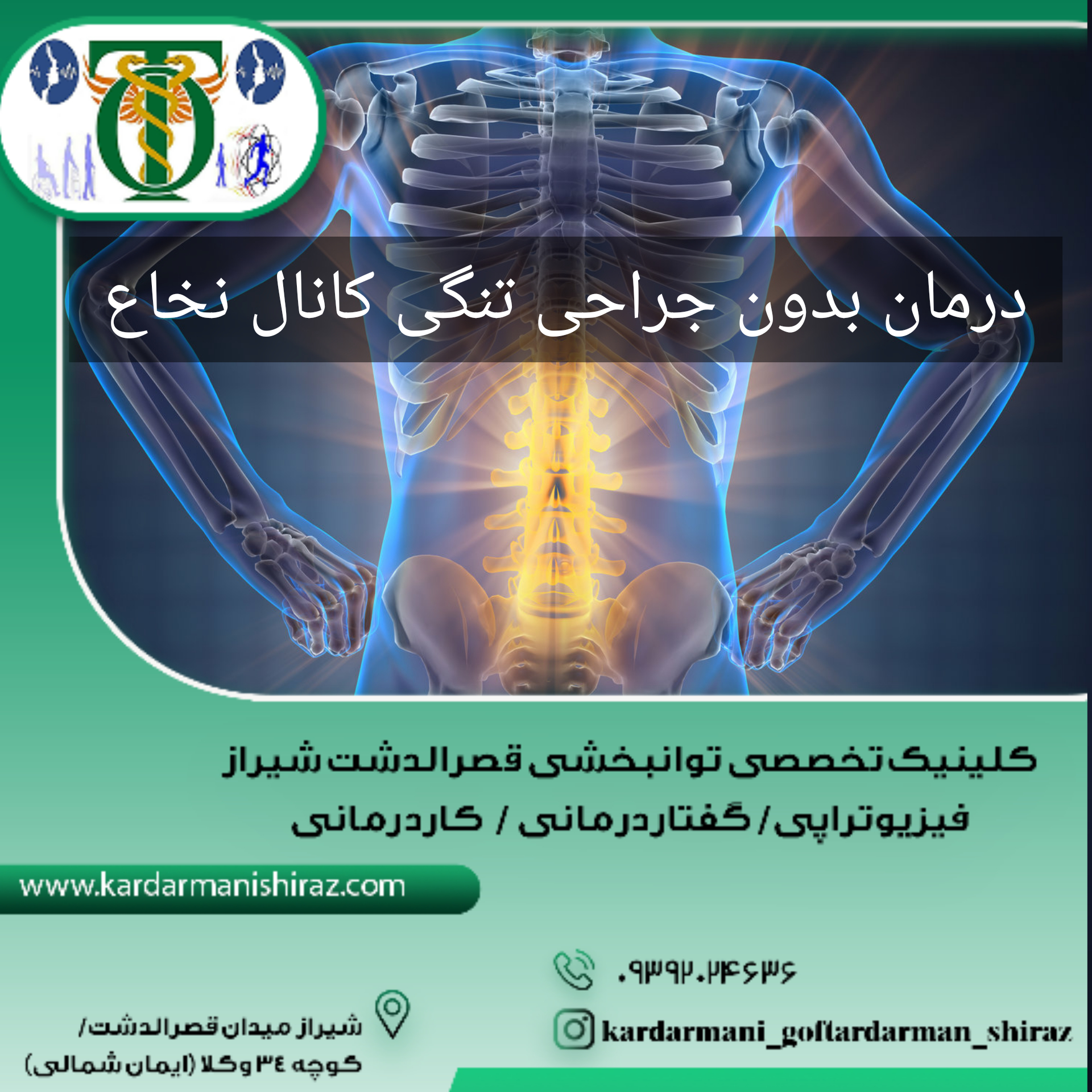 درمان بدون جراحی تنگی کانال نخاع شیراز|توانبخشی قصردشت