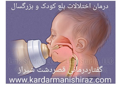 درمان اختلالات بلع شیراز،گفتاردرمانی شیراز