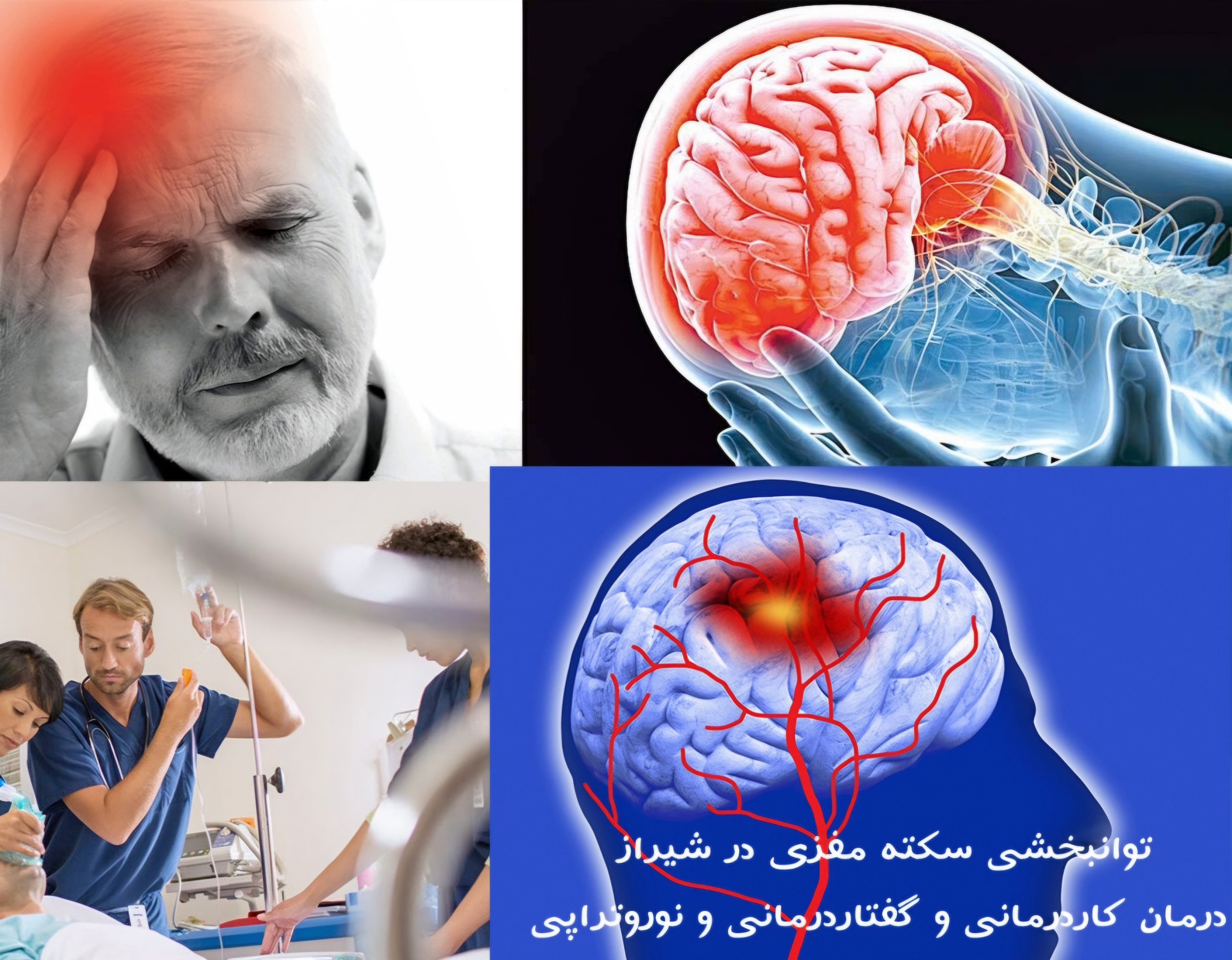 درمان سکته مغزی کاردرمانی و توانبخشی _بهترین دکتر سکته مغزی شیراز