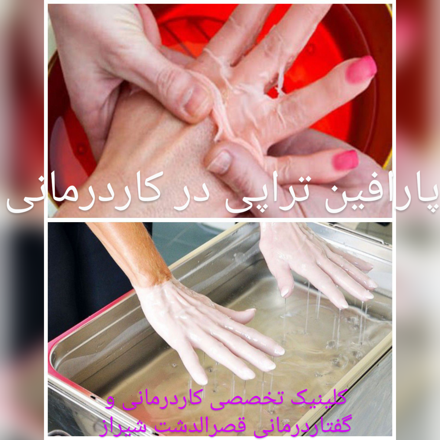 پارافین تراپی درشیراز و کاربرد های آن در کاردرمانی و توانبخشی