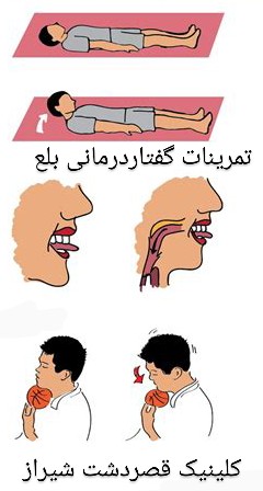 روش های تسهیل بلع در گفتاردرمانی شیراز