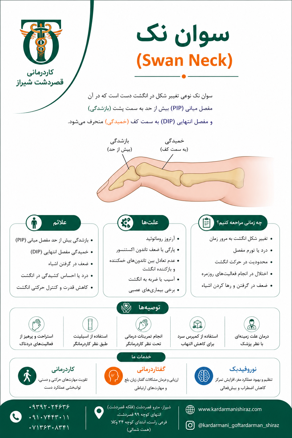 درمان دفورمیتی سوان نک (گردن قو)با کاردرمانی شیراز